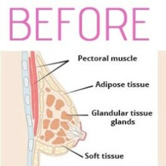 Natural Breast Enhancement Enlargement Cream - Picture 5 of 9